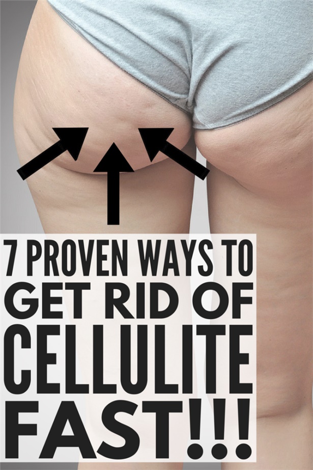 7 PROVEN WAYS TO GET RID OF CELLULITE FAST FOR A SEXY BODY
