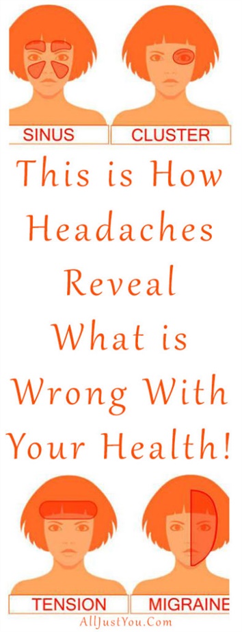 This Is How Headaches Reveal What Is Wrong With Your Health! ⋆ China ...